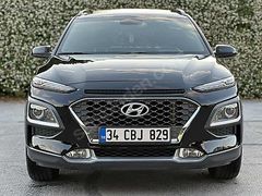 İLK ELDEN 102 BİN KM DE HYUNDAİ KONA SUNROOF HATASIZ DEĞİŞENSİZ