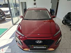 2020 MODEL HYUNDAİ KONA 1.6 CRDİ STYLE PAKET 65.000 KM BOYASIZ