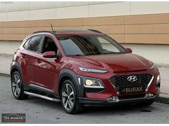 ÖZ BURAK / HYUNDAİ KONA / 2019 / DİZEL / HATASIZ / ELİTE SMART