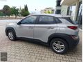 HATASIZ OTOMATİK VİTES