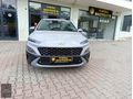 HATASIZ OTOMATİK VİTES