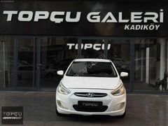 TOPÇU GALERİ KADIKÖY///DİZEL OTOMATİK FULL+FULL ACCENT BLUE