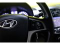 Burak'tnK.Kartna 12Taksit | Hyundai Accent Blue 1.6CRDI ModePlus