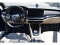 EKSPRES PLAZA'DAN 2020 SKODA OCTAVIA 1.0 e-Tec PREMIUM