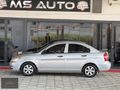 MS AUTO'DAN HATASIZ GÜNEŞ YANIKSIZ CAM GİBİ ACCENT ERA
