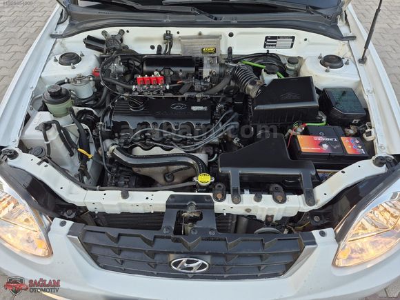 2004 MODEL LPG'Lİ HYUNDAİ ADMİRE