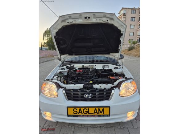 2004 MODEL LPG'Lİ HYUNDAİ ADMİRE