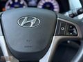 CEMSE MOTORS 2017 HYUNDAİ ACCENT BLUE 1.6 CRDİ MODE PLUS