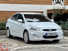 2018 MODEL AACENT BLUE DİZEL OTOMATİK BAKIMLI KREDİ KARTI GEÇER
