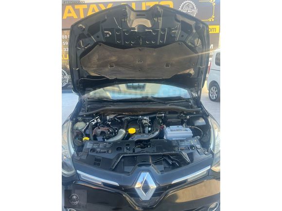1.5 DCİ TACH PAKET 2015 MODEL